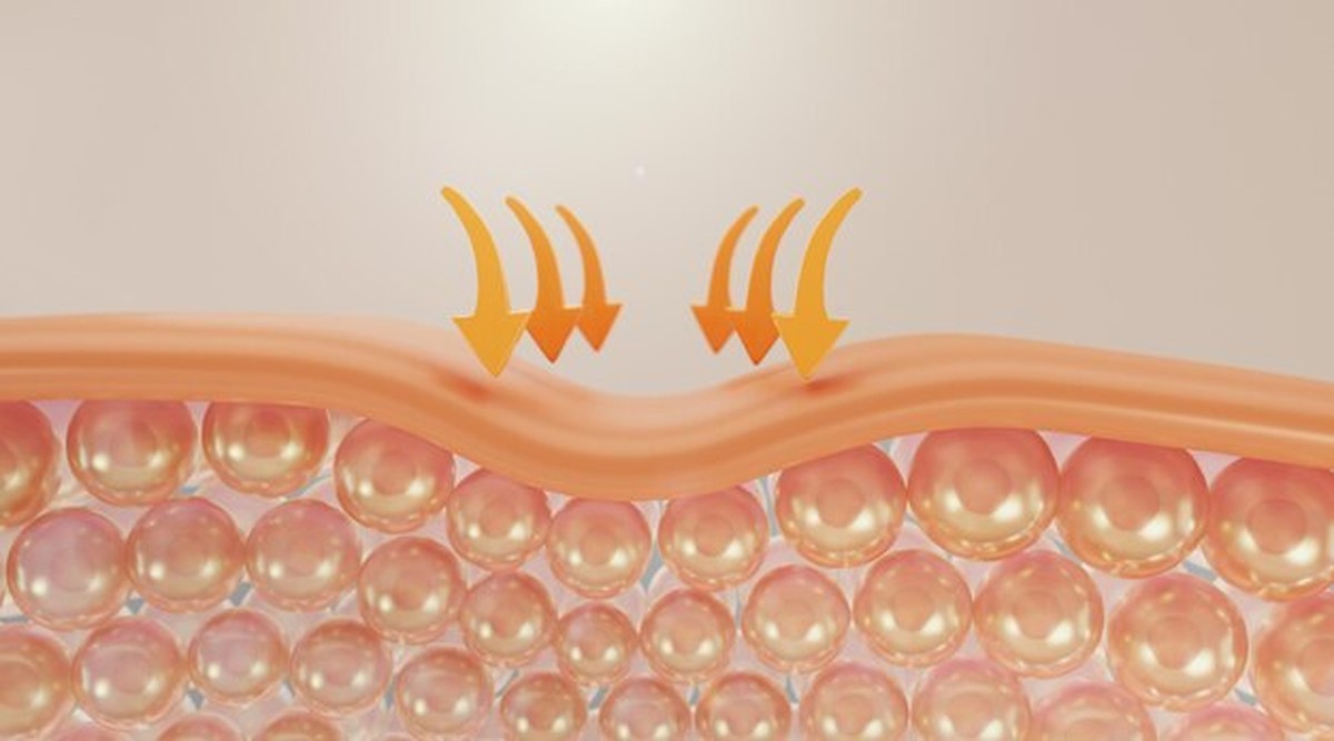 Diese 3 Hautpflege-Fehler machen Ihre Haut im Dezember schlimmer - image 2