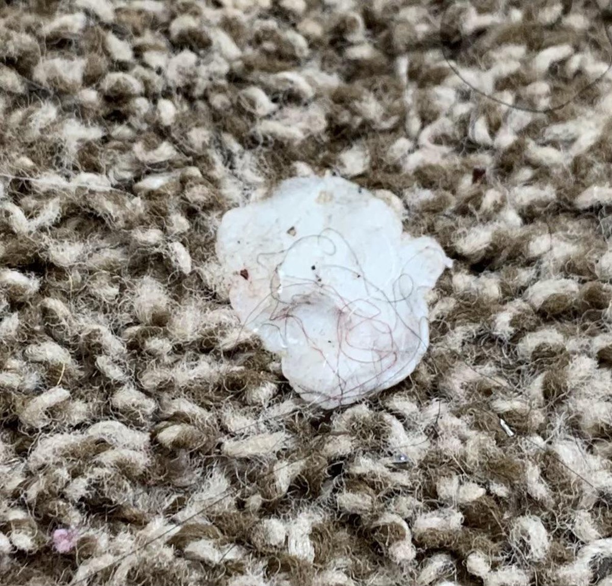 Kaugummi auf dem Teppich? Der Eistrick, den Reinigungsfirmen kennen - image 1